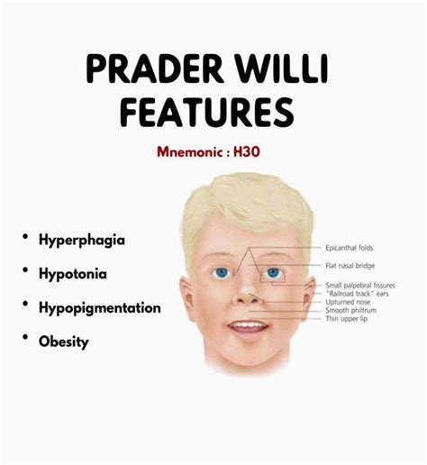 prada willy syndrom|prader willi syndrome treatment.